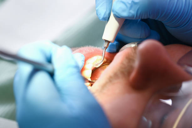 Best Emergency Denture Repair in Berkley, MI