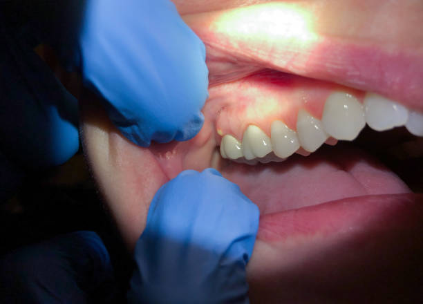 Best Same-Day Emergency Dental Services in Berkley, MI