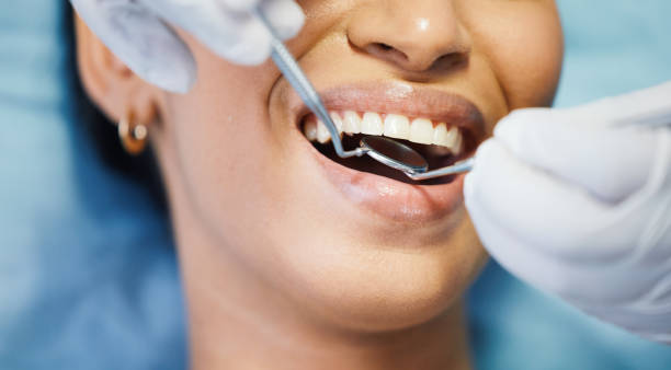Best Urgent Care for Lost Fillings or Crowns in Berkley, MI