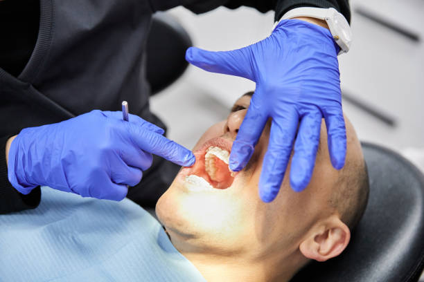 Best Emergency Tooth Extraction in Berkley, MI
