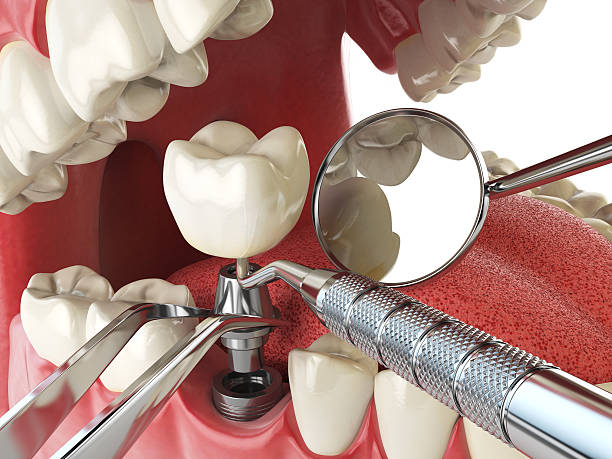 Best Emergency Gum Treatment in Berkley, MI